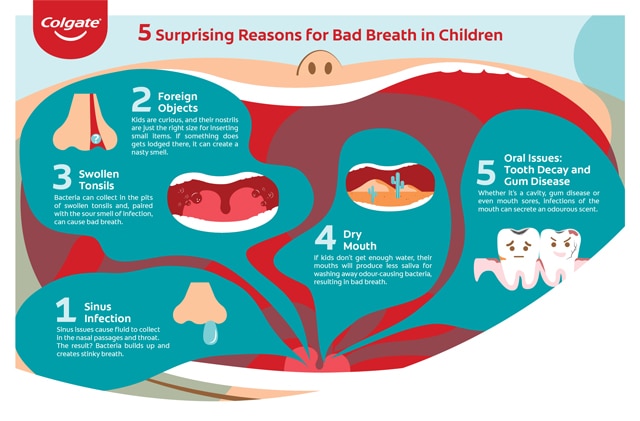Five causes of bad breath in children