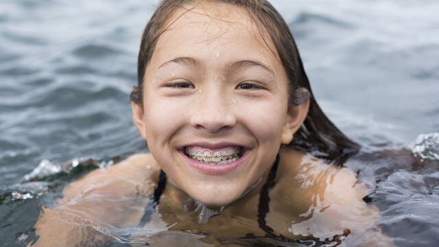 teeth spacers for kids - colgate au