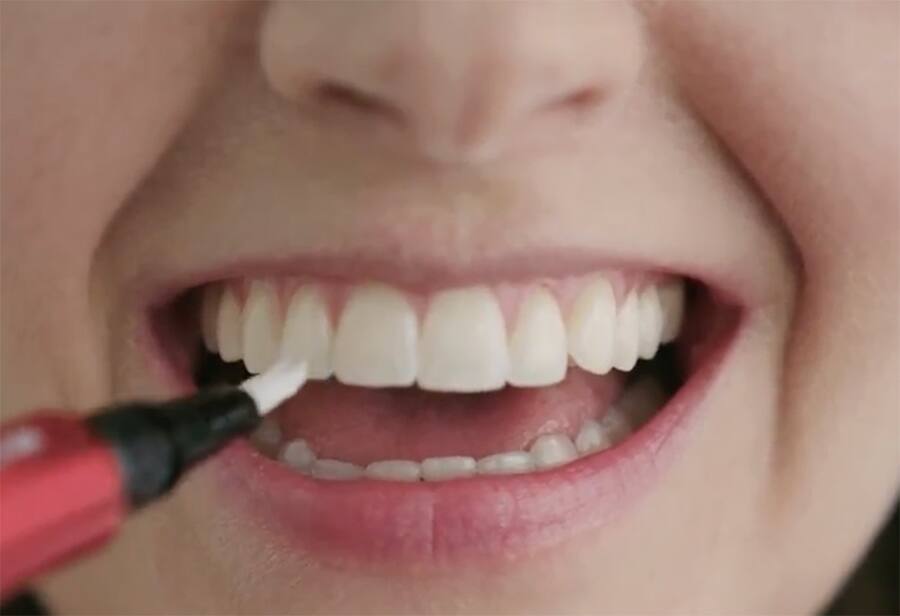 young woman applying the serum on her teeth