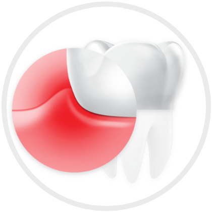 Image healthy gums