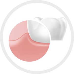 Image of healthy gums