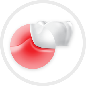 Image of unhealthy gums