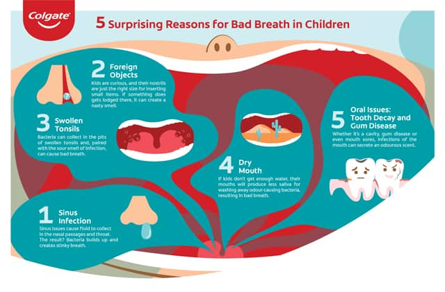 Five causes of bad breath in children