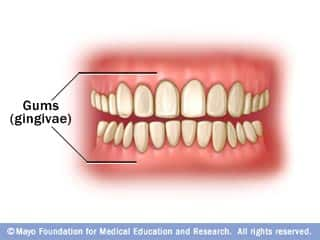 Gums (gingivae)